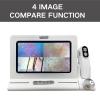 PLABNK 11-Inch Skin & Hair Analyzer, Wireless Wi-Fi Scalp & Hair Follicle Detector, 50x/200x Magnification, White view 4