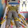 AYCDL Full-Body Patient Lift and Transfer Sling with Head Support, 180 kg Capacity view 2
