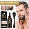 Beard Growth Kit with Beard Roller and Serum view 4