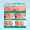 Lukcr Advanced Scar Spray, Medical-Grade Scar Spray/Cream After Surgery, for All Types of Scars (2 pcs) view 2