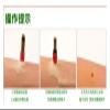180 Mini Moxa Tubes, Self-Adhesive Moxibustion Stickers view 4
