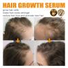 Tkekruh 2-Pack Biotin Hair Growth Serum, 30 mL view 3