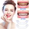 Prosthetic Fake Teeth, 2 Pairs of Clip-On Teeth, Upper and Lower Temporary Cosmetic Veneers view 3