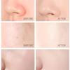 Rejuvenating Honey Peel-Off Mask, 100 g (2 pcs) view 3