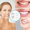 Brigtviee Instant Veneers - 2 Pairs view 2