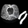 100 Transparent Elastic Hotel Shower Caps view 1