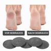 RAMGLYO 10-Pack Electronic Foot File Replacement Heads, Callus Remover Rollers, Black view 4