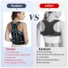 Posbaer Back Posture Corrector, Comfortable Adjustable Back Support Belt for Men and Women, Open Your Shoulders (Black 01, L) view 3