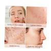 Brown Wooden Facial Cleansing Brush with Bristles for Face and Scalp view 4