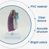 Medical Pathological Human Lung Model, 2/3-Scale Lung Cancer Model for Study view 3
