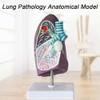 Medical Pathological Human Lung Model, 2/3-Scale Lung Cancer Model for Study view 4