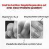 outfany Nagelmeister Pro Nail Clipper for Thick Senior Toenails view 2