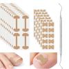 CVNRCLP 17-Piece Ingrown Toenail Treatment Kit view 1