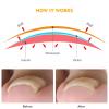 CVNRCLP 17-Piece Ingrown Toenail Treatment Kit view 4