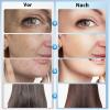 Blayram High-Frequency Facial Wand for Acne Treatment, Massage and Skin Tightening, Blue view 4