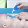 Manual Nasal Aspirator for Babies and Newborns, 4-Pack view 4