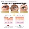 Retinol Eye Stick with Collagen, Hydrating Under-Eye Balm for Dark Circles and Puffiness (6 pcs) view 2