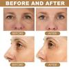 Retinol Eye Stick with Collagen, Hydrating Under-Eye Balm for Dark Circles and Puffiness (6 pcs) view 3