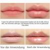 Rostblant 5 ml Natural Lip Plumper, Lip Care Balm for Fuller Lips, Clear Lip Gloss view 2