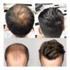 Men's Toupee, Swiss Lace Front, Remy Human Hair System (Medium Brown, 8 x 10 in) view 3