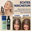 Hair Growth Shampoo for Hair Loss with Biotin and Caffeine for Women and Men, Accelerates Hair Growth and Reduces Hair Loss (3-Piece Set) view 4