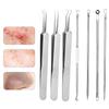 7-Piece Blackhead Remover Set, Stainless Steel Tools view 1