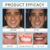 LUHAKA Silicone Denture Reline Set, Lightweight Dental Appliances for Men and Women, 3 Sets view 4
