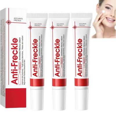 Whitening Cream for Dark Spots, Melasma, and Freckles