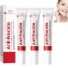 Whitening Cream for Dark Spots, Melasma, and Freckles view 1