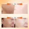 Vitamin C Facial Skincare Travel Sets, 4-Piece Moisturizing Face Care Set (2 Sets) view 4