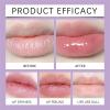 Moisturizing Lip Balm, 4 ml view 4