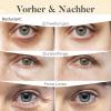 Daytime Caffeine Eye Patches for Dark Circles - 30 Pairs view 4
