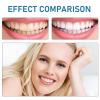 Care Spring DIY Dentures, 2-Piece Clip-On False Teeth for Upper and Lower Teeth view 4