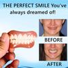 Care Spring 2-Piece Clip-On Cosmetic Veneers for Men and Women, Upper and Lower, One Size Fits Most view 4
