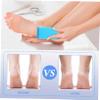 6-Pack Foot Pumice Stones for Callus Removal and Exfoliation view 3