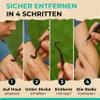 Tick Removal Tool for Dogs, Cats & Humans view 3