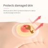 10-Piece Stoma Barrier Rings, Self-Adhesive Stoma Care for Colostomy Bags, Skin Protection and Leak Prevention, Moldable Barrier Rings (2 mm: 60 pcs) view 3