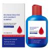 Shampoo for Oily Hair, Gentle, Nourishing, Refreshing, and Repairing view 1