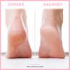 Footglow Electric Callus Remover for Pedicures view 2