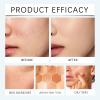 2-Pack All-Over Complexion Perfector CC Cream, Long-Lasting Foundation and Concealer view 2