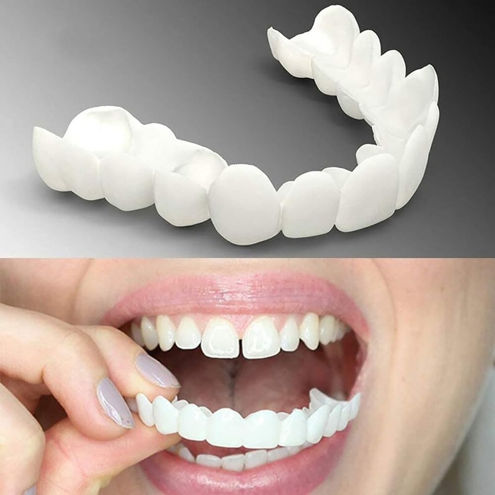 Brigtviee 2 Pairs False Teeth Veneers