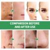 Centella Foaming Facial Mask, Deep-Cleansing Bubble Mask view 2