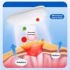 QiaoRong Left-Sided Inguinal Hernia Belt for Men and Women with 2 Removable Compression Pads, Adjustable (Small) view 4