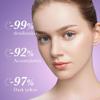 Dark Spot Remover for Face, Niacinamide Freckle-Removing Serum, Brightening Body Cream, Hydrating Facial Serum (5-Piece) view 2