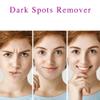 Dark Spot Remover for Face, Niacinamide Freckle-Removing Serum, Brightening Body Cream, Hydrating Facial Serum (5-Piece) view 4