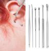 6-Piece Stainless Steel Earwax Removal Tool Set with Case view 4
