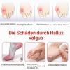 Eddrfy 2-Pack Hallux Valgus Corrector Sleeves, Invisible Lycra & TPE Bunion Socks for Day and Night view 4