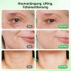 Facial Massage Device for Wrinkles view 2