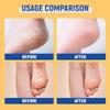 60% Urea Moisturizing Anti-Crack Foot Cream view 4