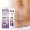 Advanced Scar Gel for Face and Body, Moisturizing and Nourishing, 1 Piece view 3